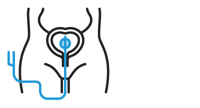 Estudio urodinámico completo – Dr. Javier Heredia, urólogo en Santa Cruz